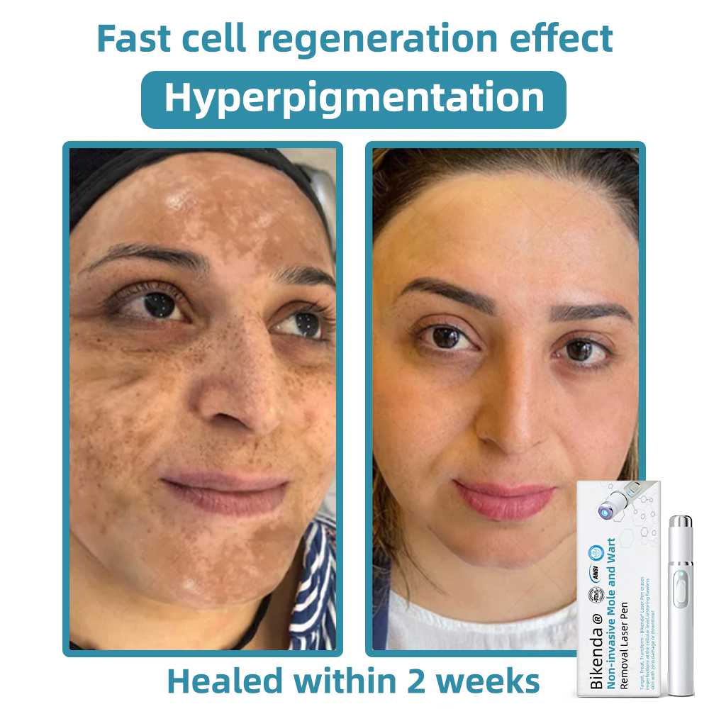 LumiRaze - Skin Care Pen for Spot Coverage & Precision Grooming