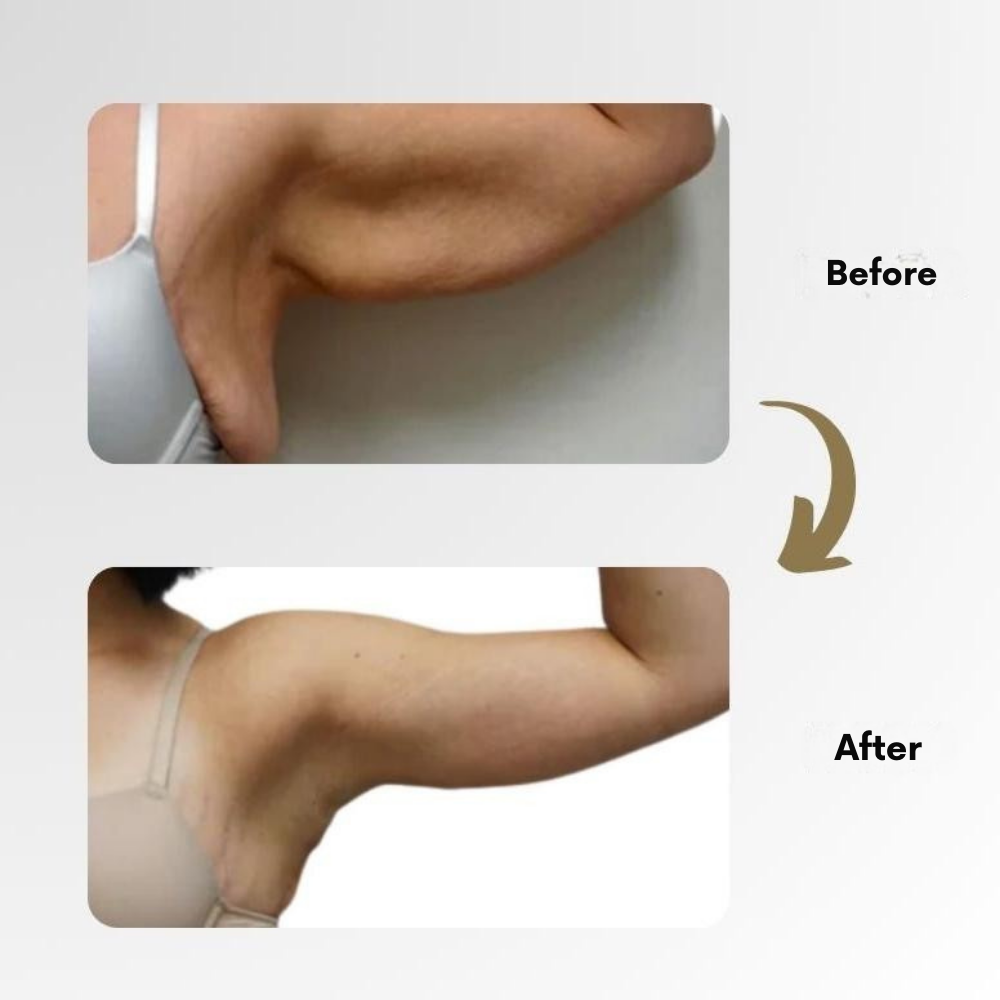 LymphMag Ring — Ignite Your Fat-Burning Power and Unleash Explosive Energy