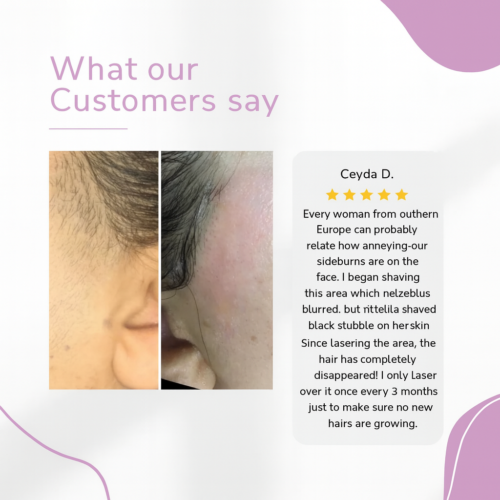 IPL Hair Remover – At-Home Light Hair Removal Device