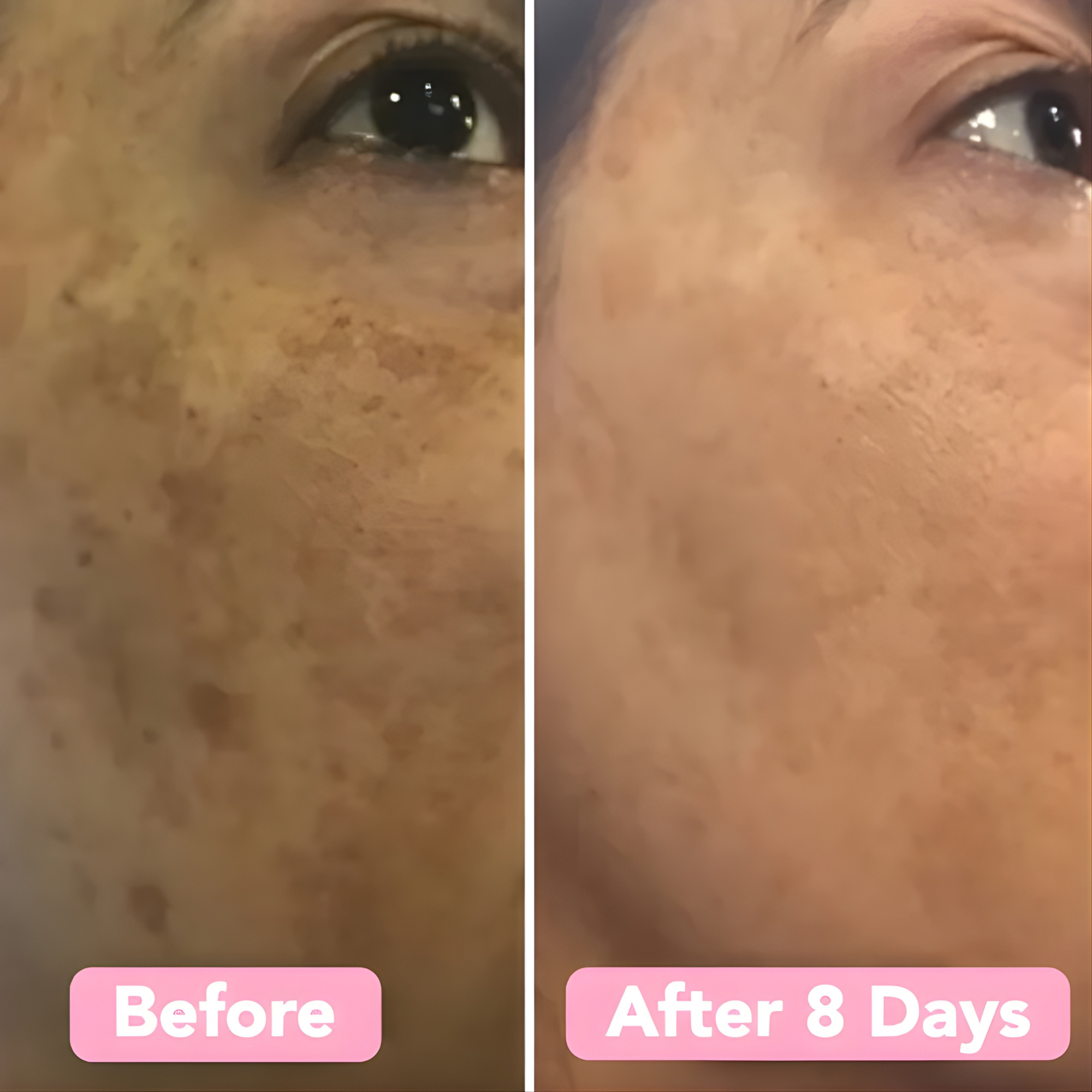 Discos iluminadores LumaSkin — discos exfoliantes para el rostro