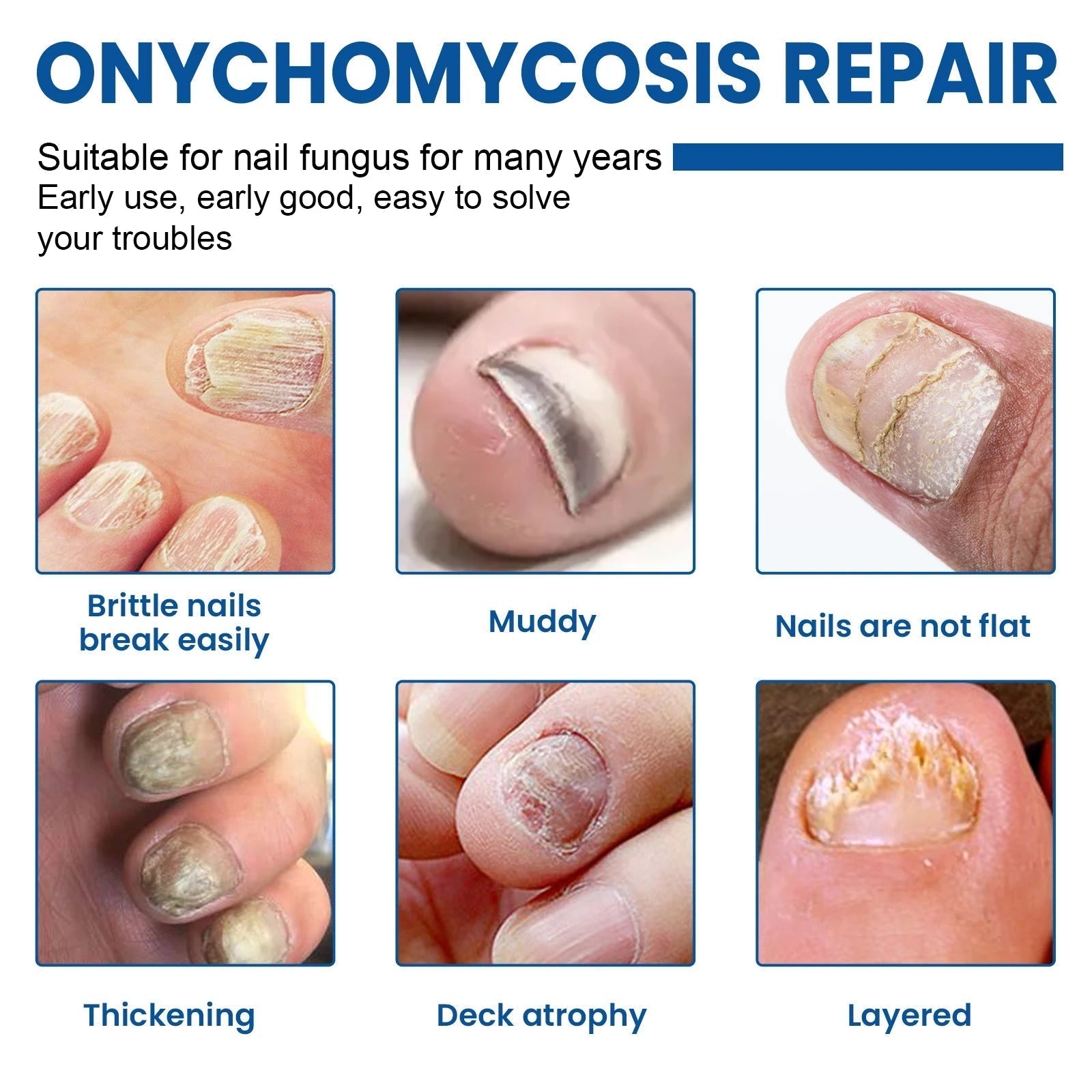 Nail Care Repair Patches for Damaged and Discolored Nails