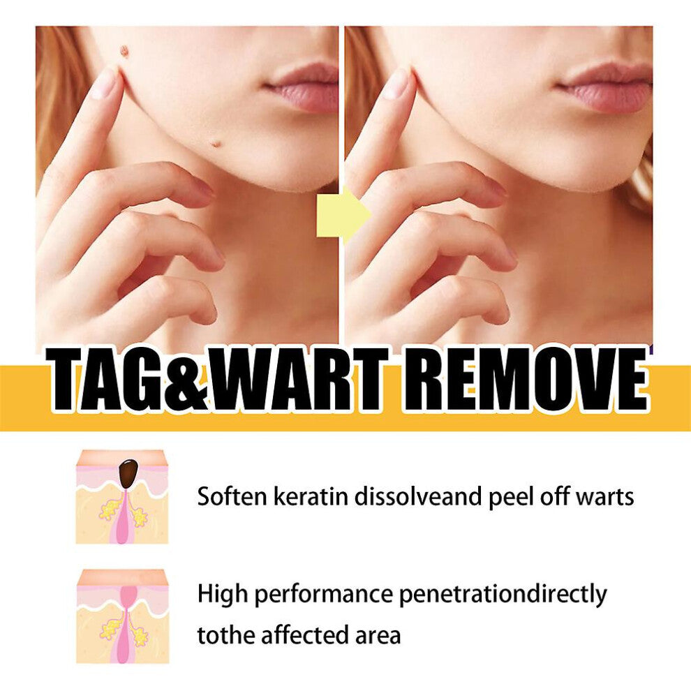 GlowQuell — Lápiz removedor de precisión para etiquetas cutáneas y lunares