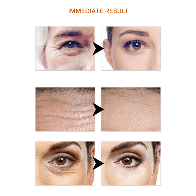 Sérum SkinVibe — Sérum facial hidratante