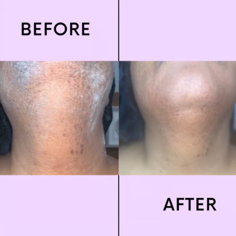 SmoothEase - Facial Hair Removal Cream Duo