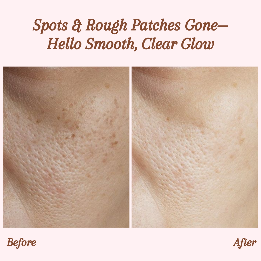 RevitaDerm — Gentle Exfoliating Gel for Daily Skin Care