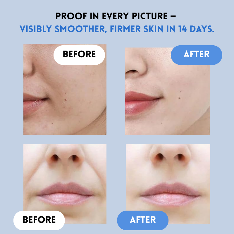 YouthLift – fornyelsesstrimler til et glattere hududseende