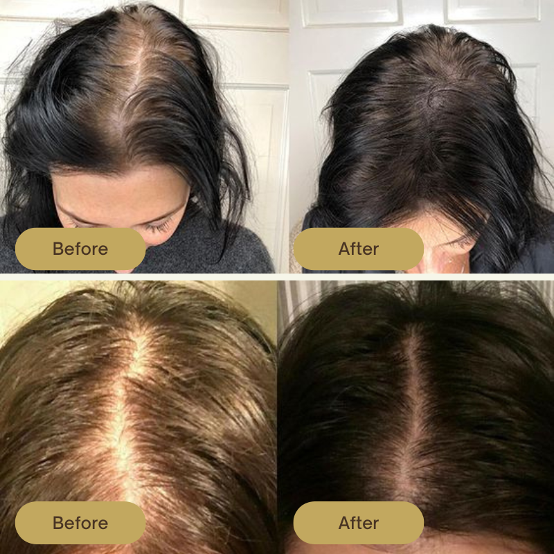 FolliPrime - Synergy Oil Set with Scalp Massager