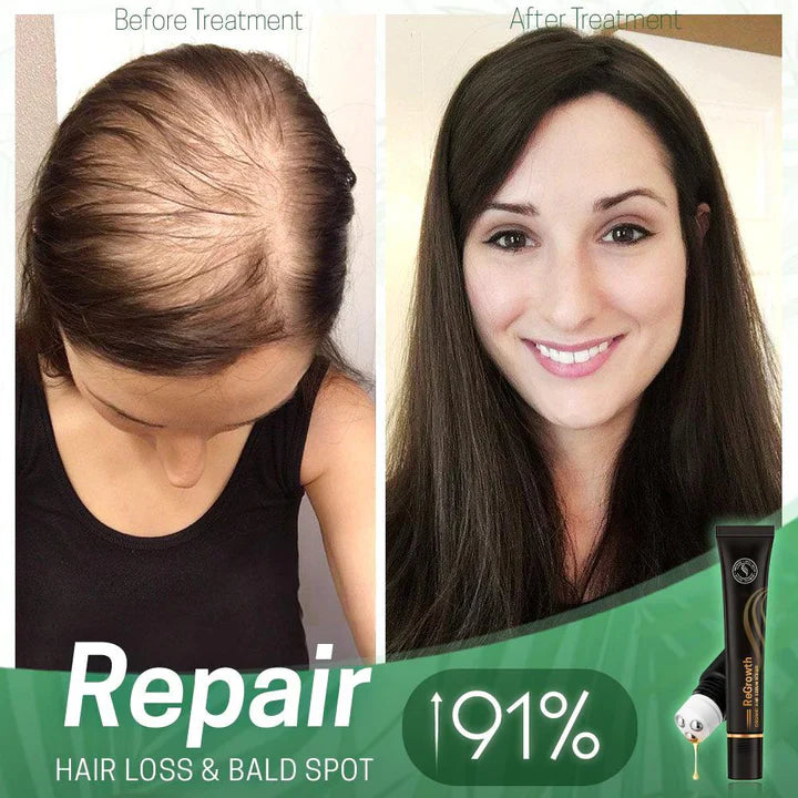 StrandSurge Serum — Hair Growth Serum with Roller Applicator