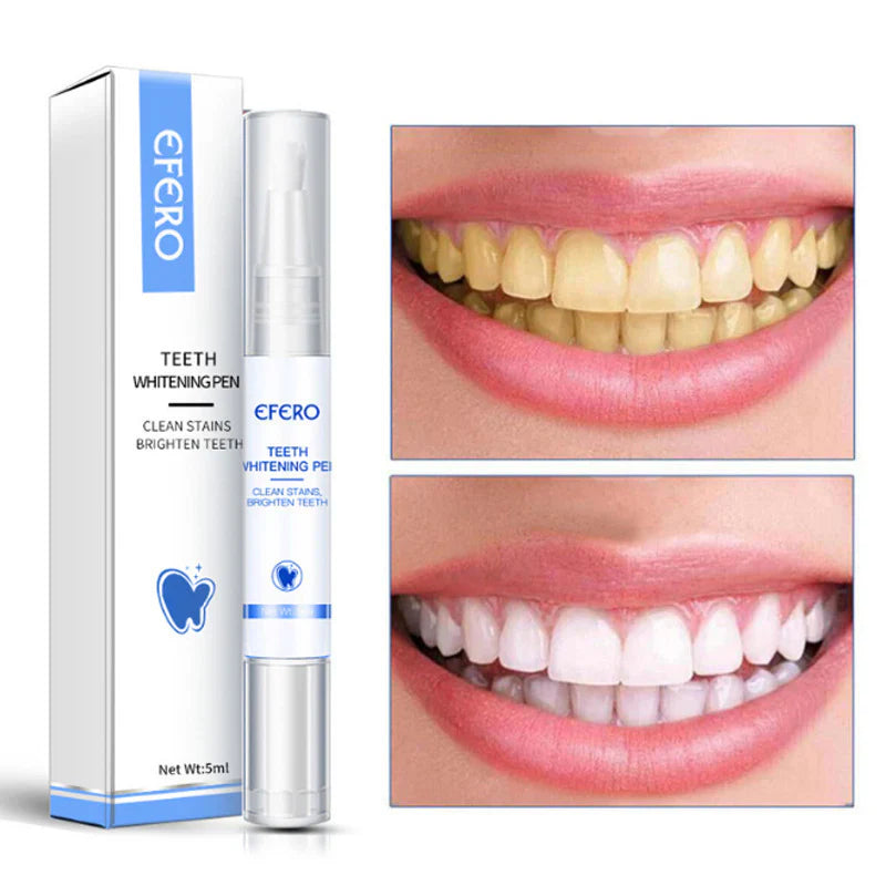 Smiley Teeth Whitening Pen – On-the-Go Bright Smile