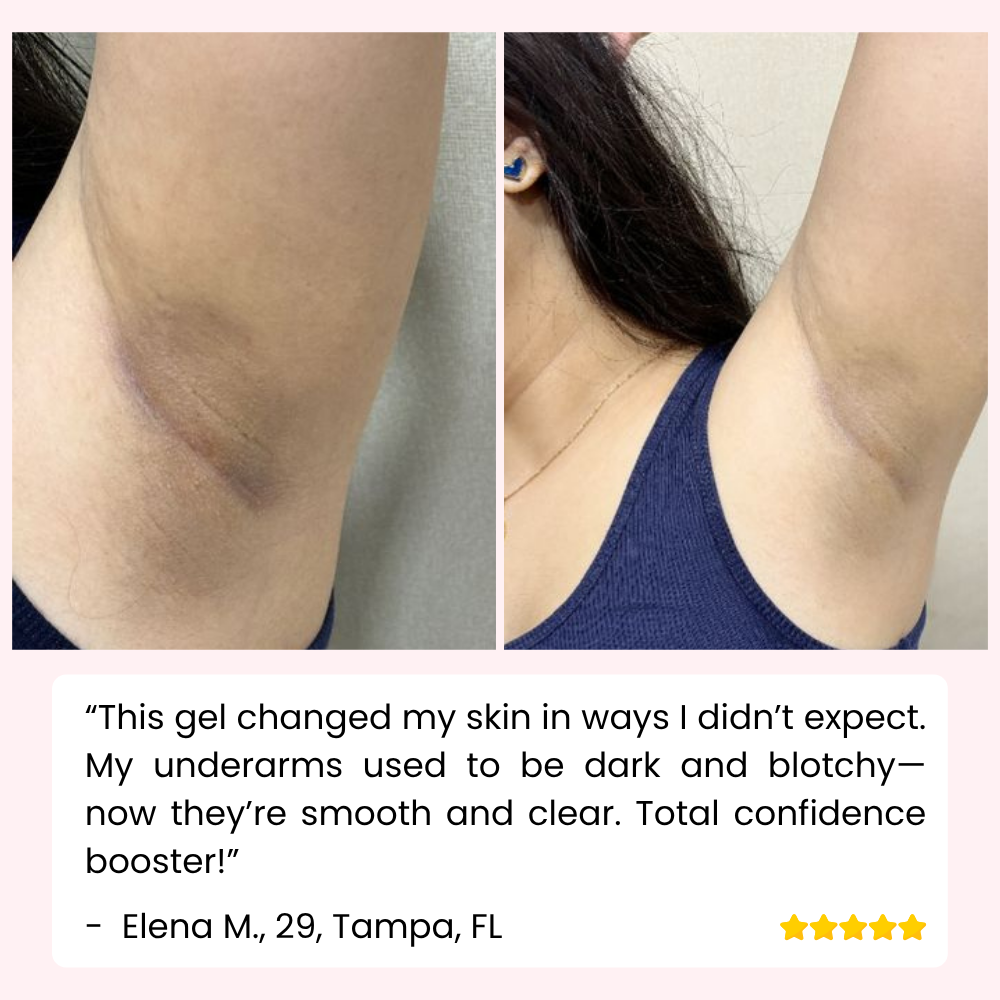 RevitaDerm — Gentle Exfoliating Gel for Daily Skin Care