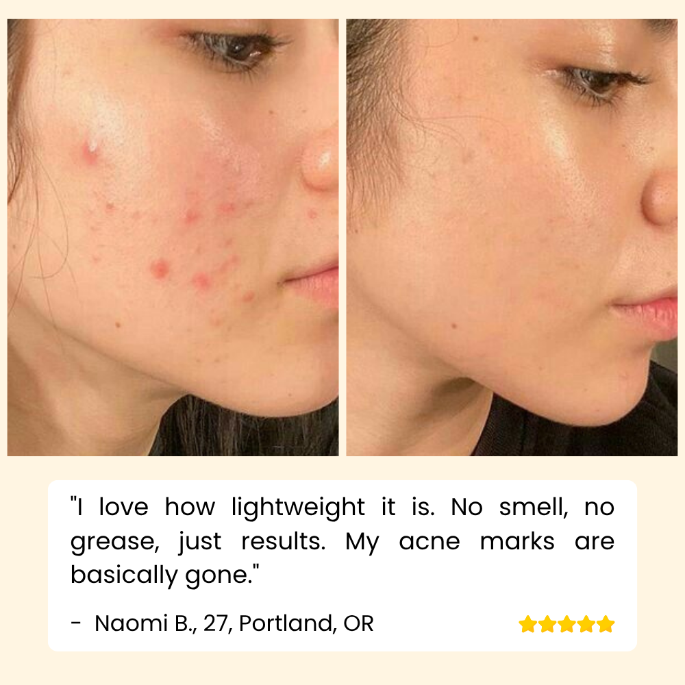 EELHOE - Eternity Vitamin C Serum for Face, Hands & Body