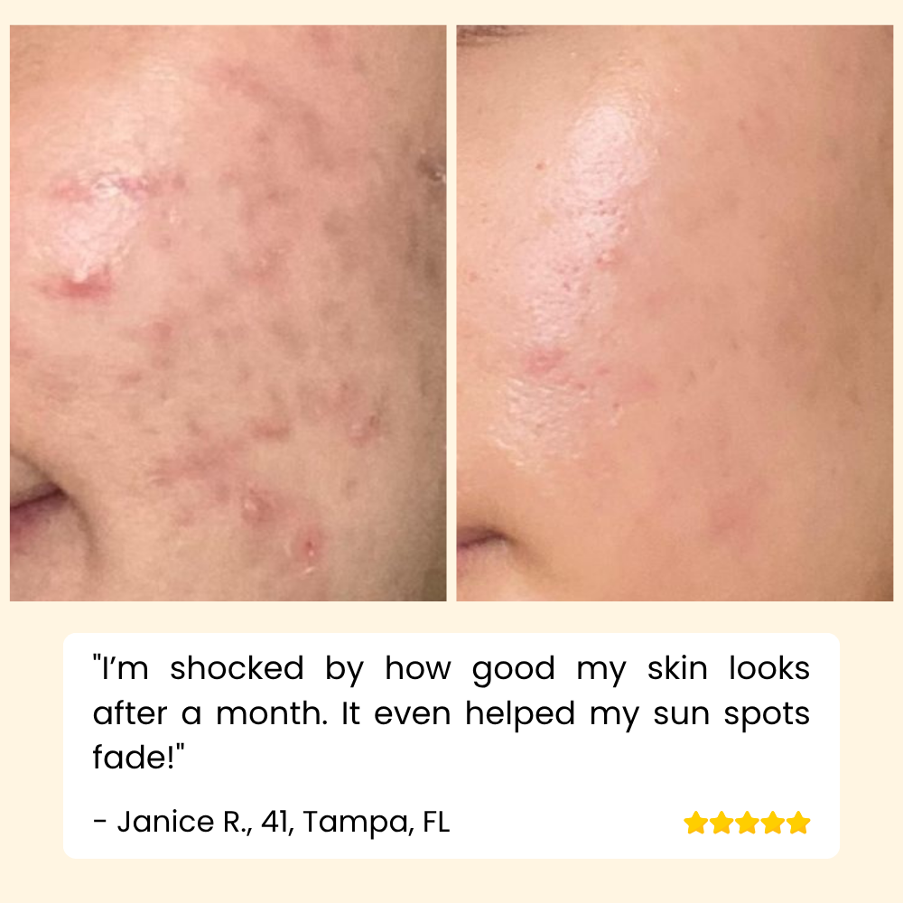 HOYGI - Sérum de vitamina C Eternity para rostro, manos y cuerpo