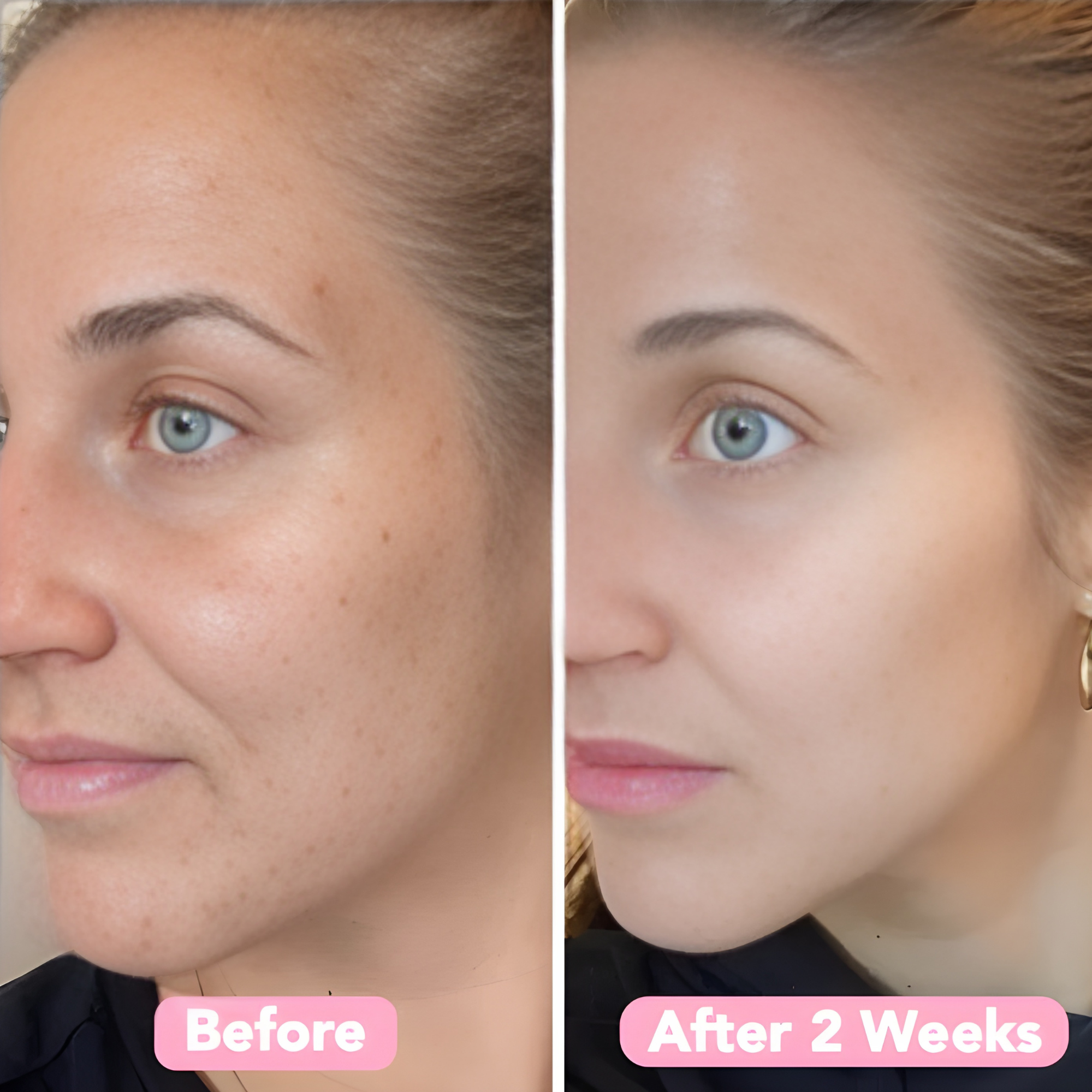 Discos iluminadores LumaSkin — discos exfoliantes para el rostro