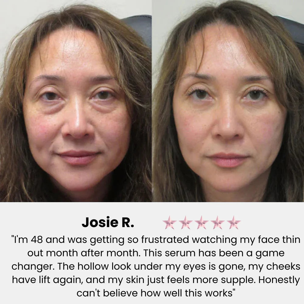 VivaDerm — Dual-Layer Collagen Cream-in-Serum