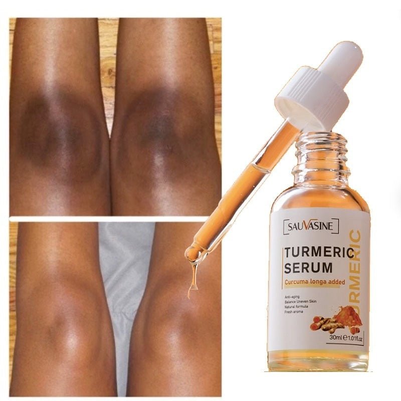 LumiVera — Sérum Visage au Curcuma Éclaircissant
