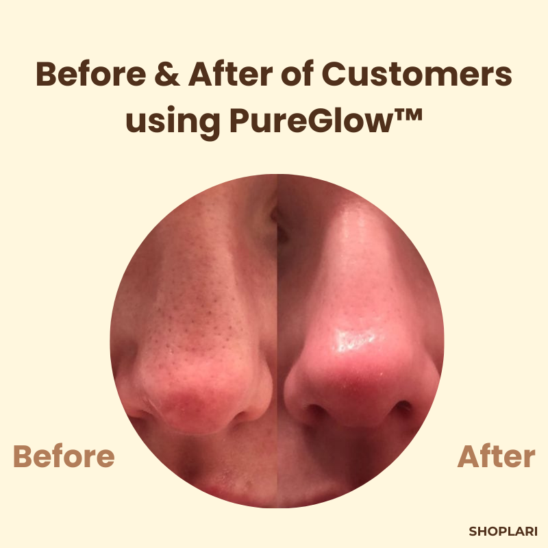 PureGlow - Peel Off Face Mask for Facial Skincare Routine