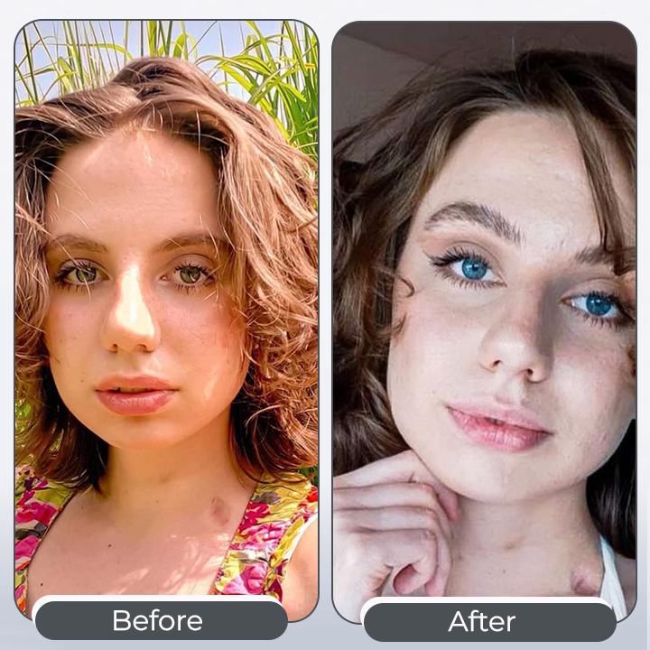 EyeKolor - Iris Enhancing Eye Drops – Vibrant Eye Look