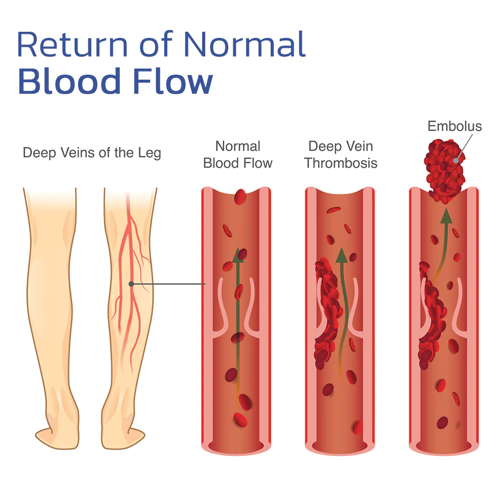 ZenPulse – EMS podložka na akupresúrnu masáž chodidiel