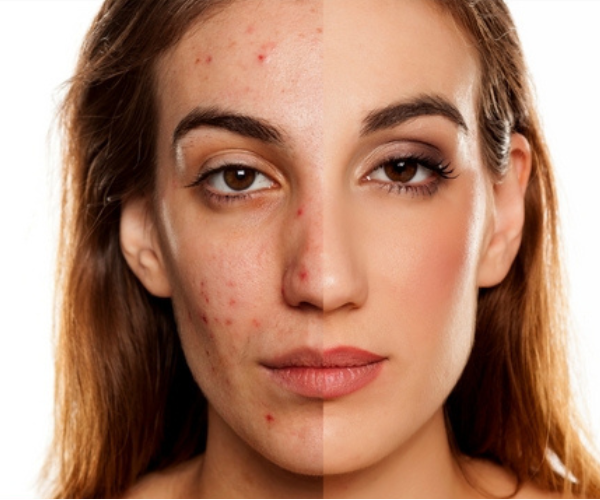 Mila – Tříbarevná paleta korektorů