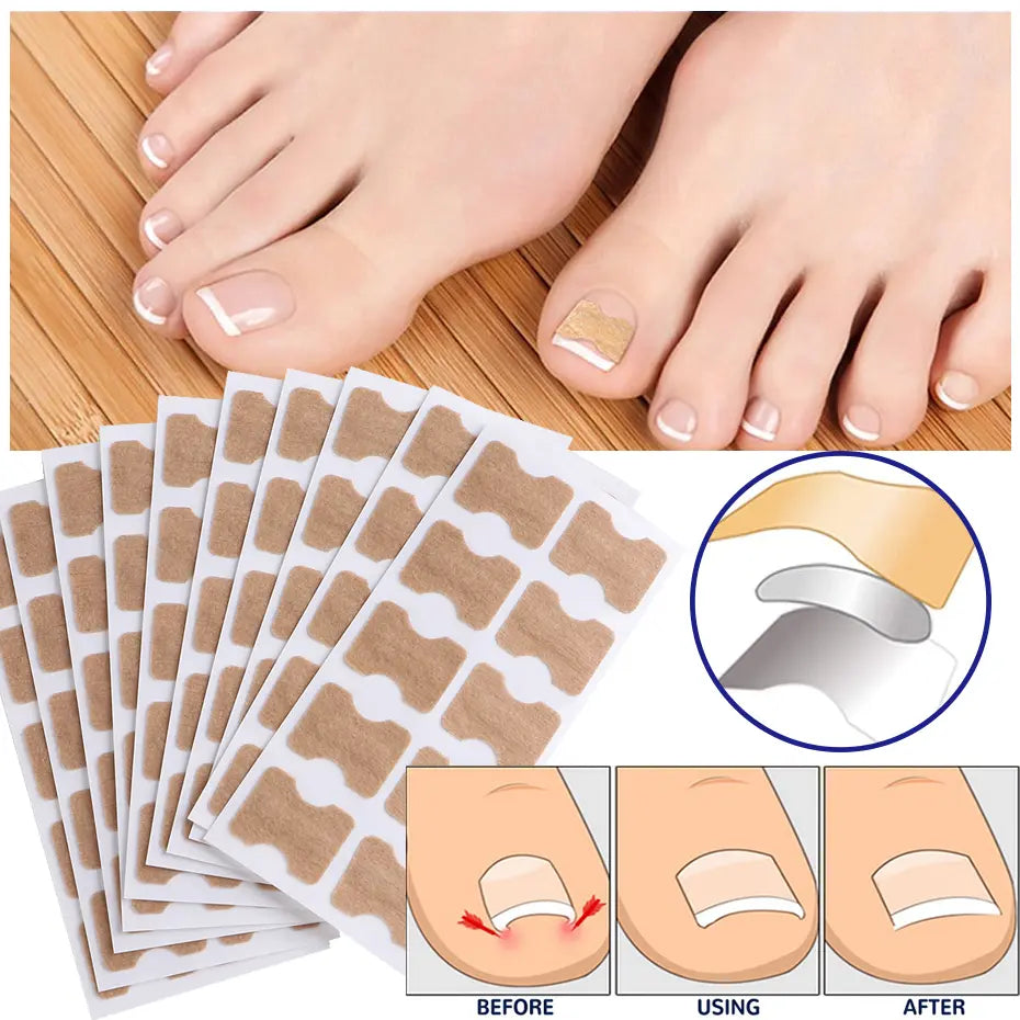 HealthyNail – Nail Care Patches for Natural Nail Appearance