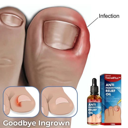 ToenailPlus - Anti-Paronychia Ingrown Toenail Care Oil