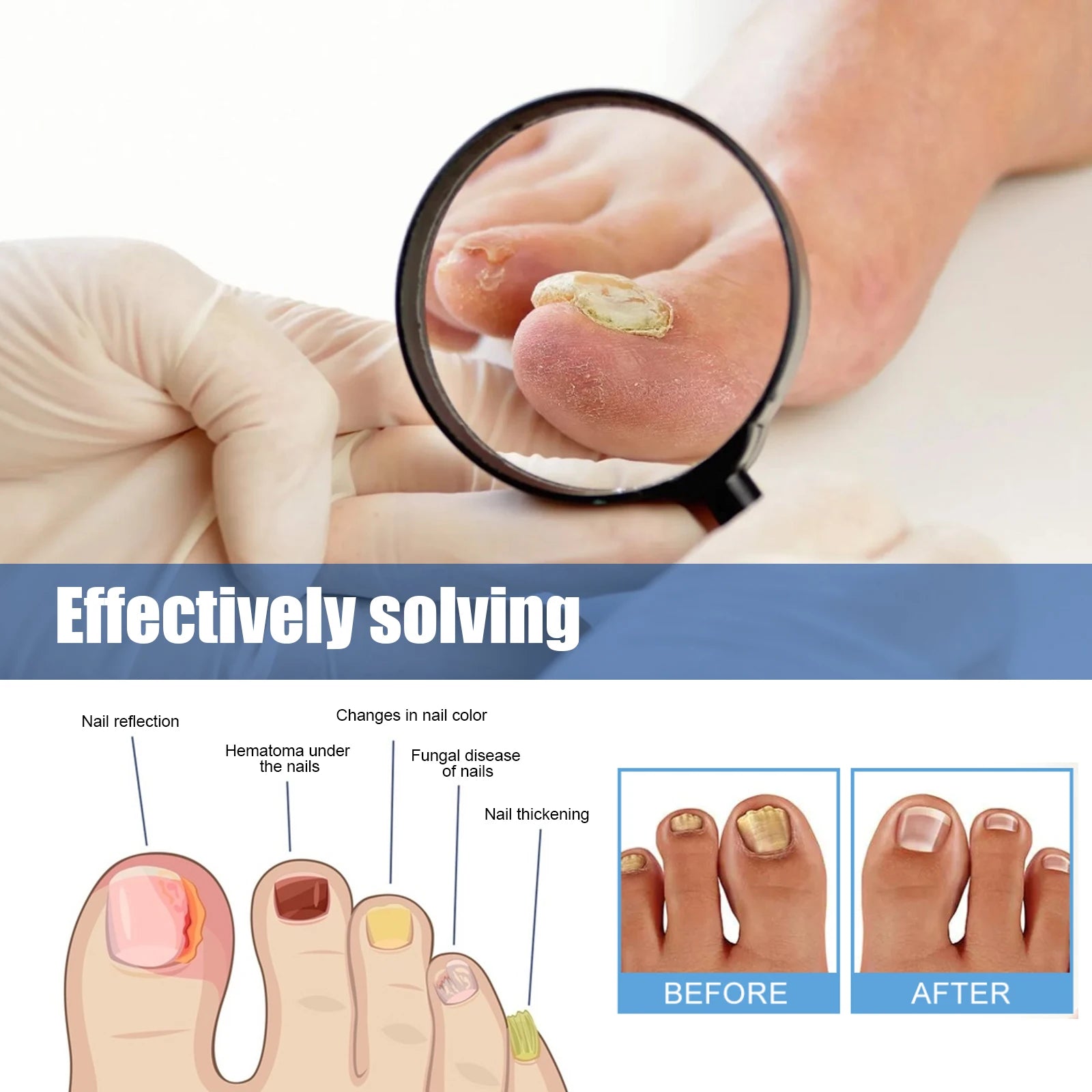 Nail Care Repair Patches for Damaged and Discolored Nails