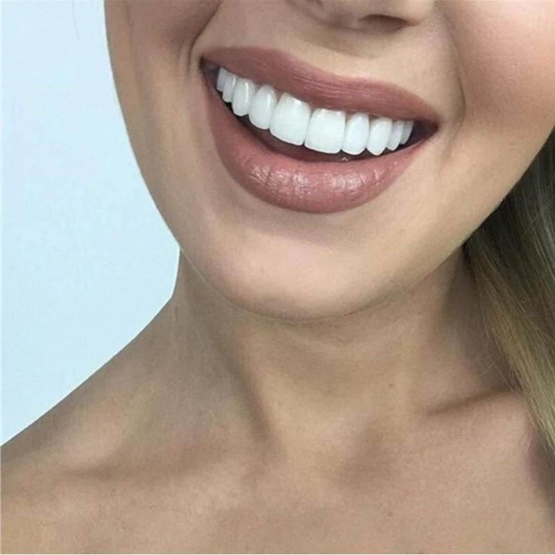SmileSculpt — Removable Snap-On Veneers for a Brighter Looking Smile