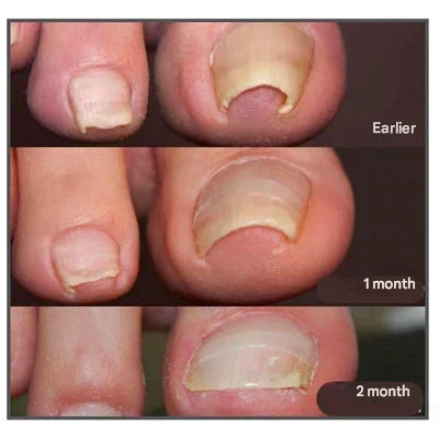 HealthyNail – Nail Care Patches for Natural Nail Appearance