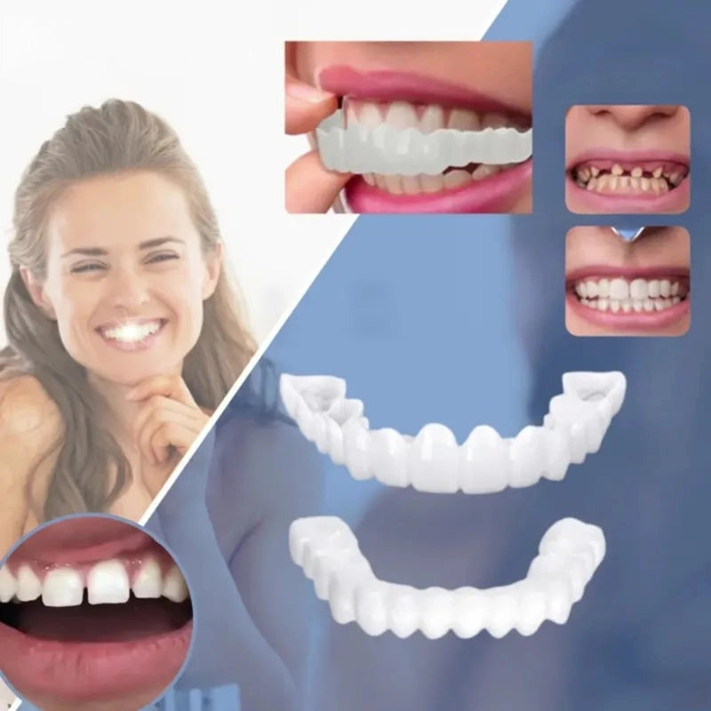 SmileSculpt — Removable Snap-On Veneers for a Brighter Looking Smile