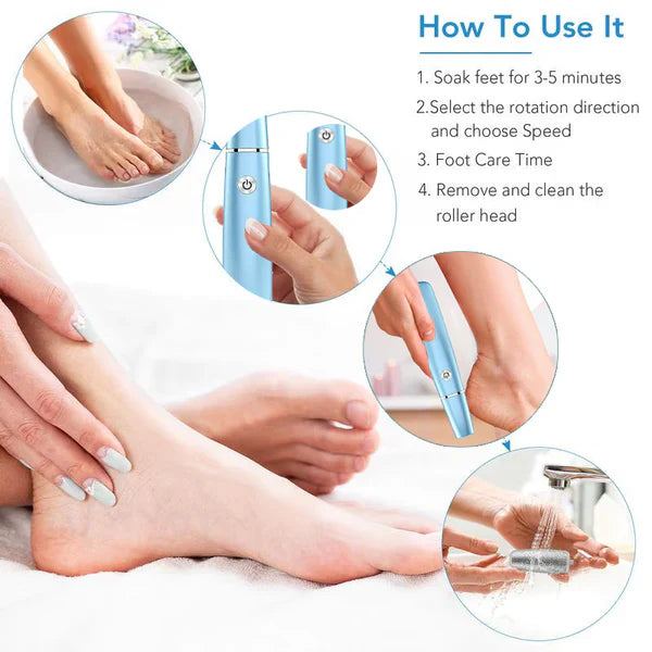SoleSmooth - Electric Foot Callus Remover