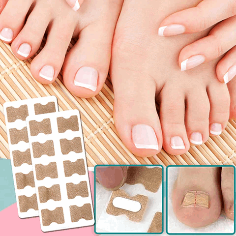 FinePatches - Nail Care Patches