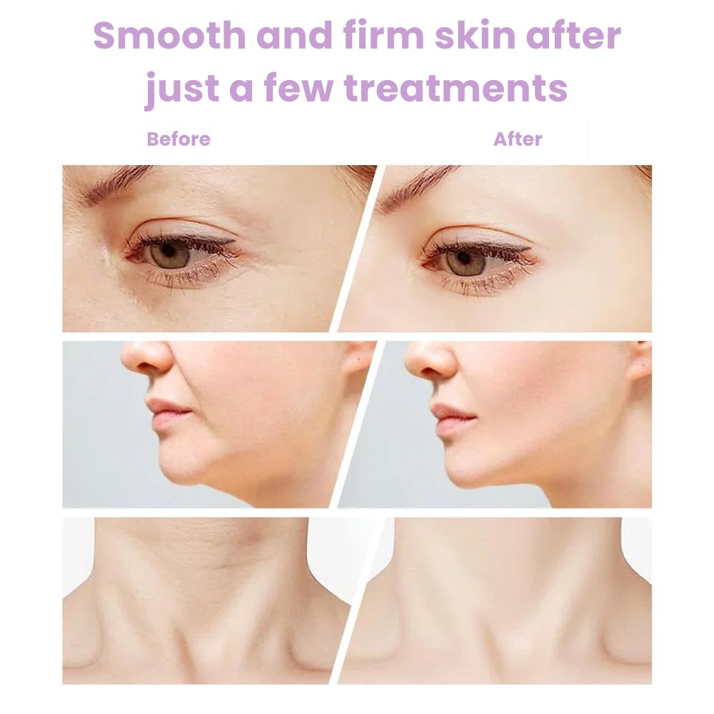 MaxReju - Neck & Facial Massage Device