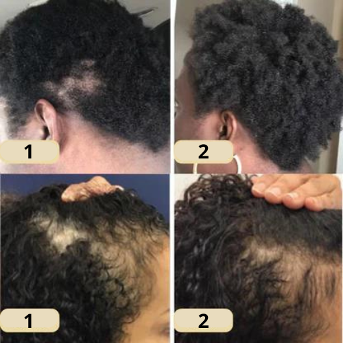 Hair & Scalp Care Oil for Daily Nourishment