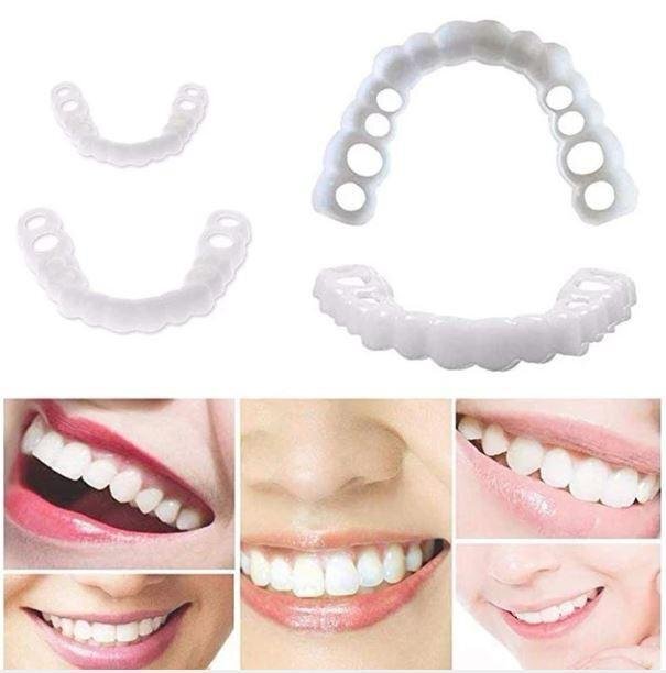 Snap-On - Clip-On Cosmetic Smile Cover
