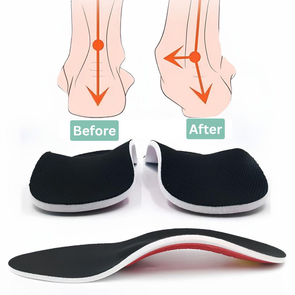 ArchEase - Arch Support Shoe Insoles