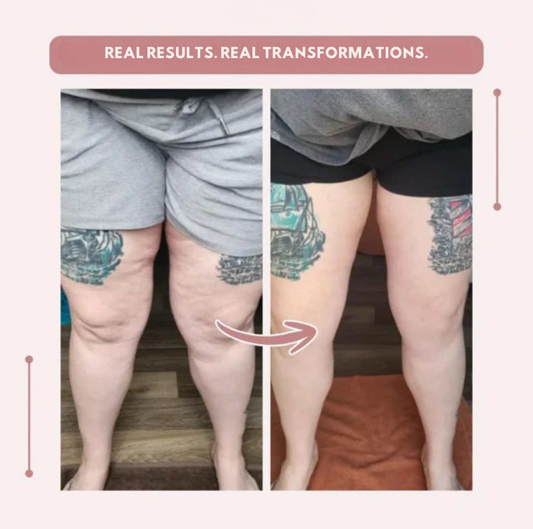 AquaLure — Korkeavyötäröiset kompressioleggingsit