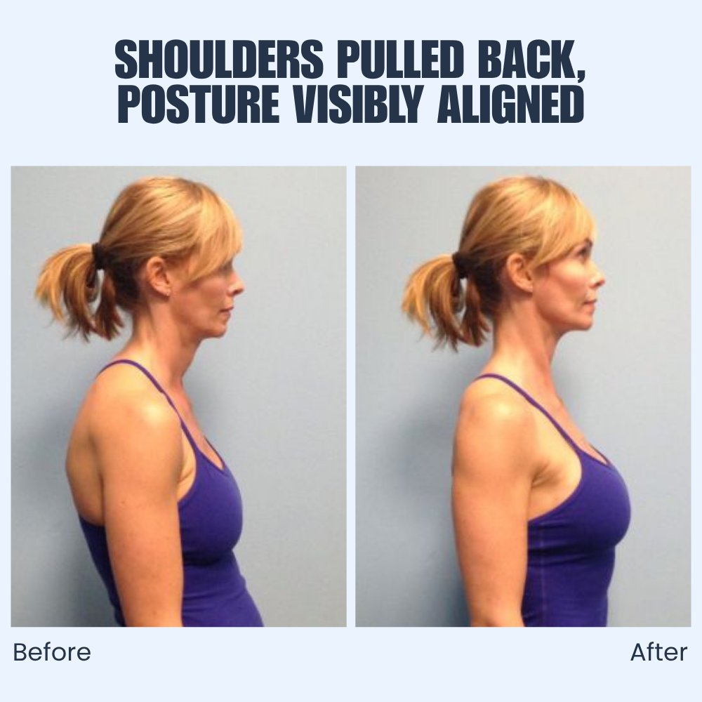 SpineLift — Adjustable Posture Support Brace