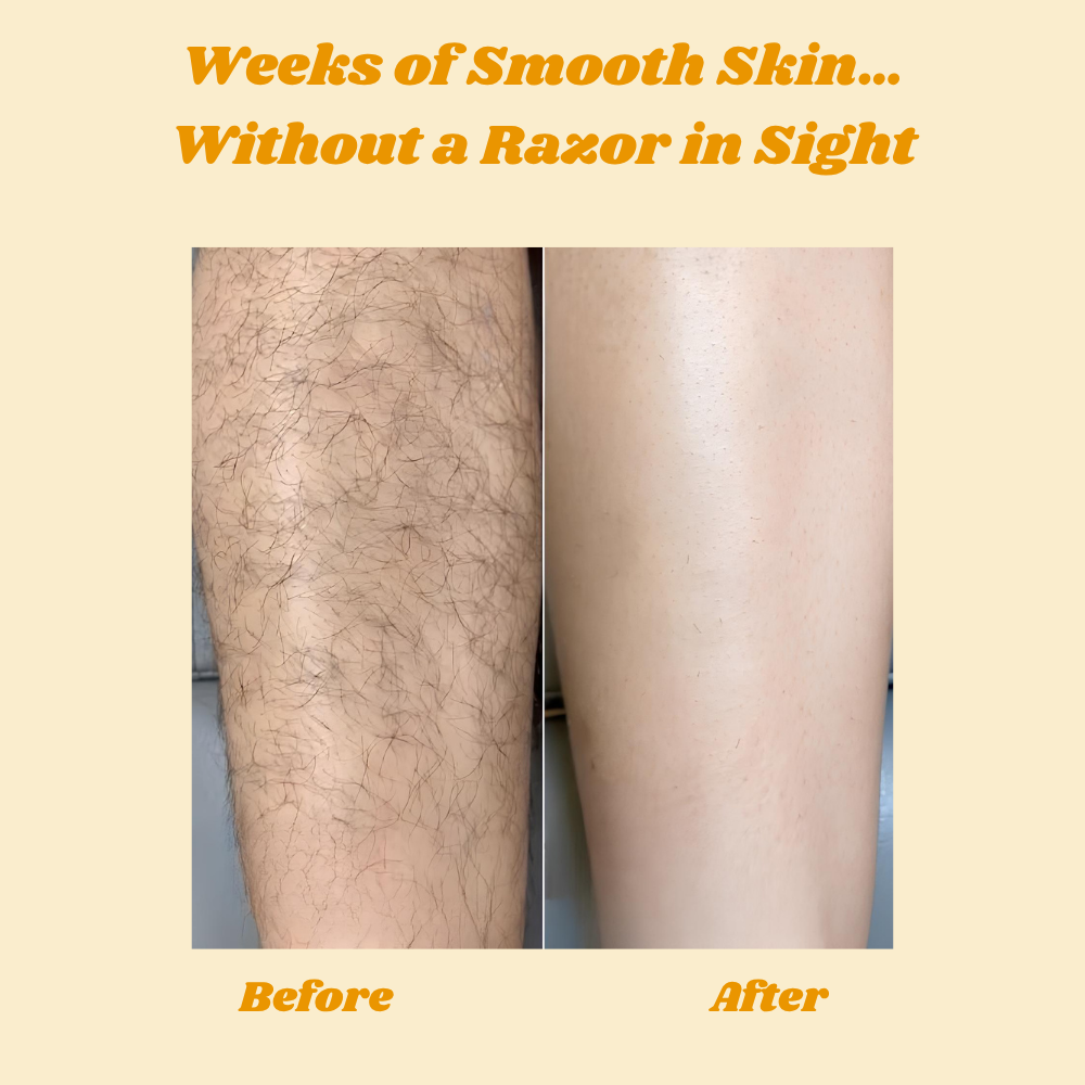 HoneyMousse - Hair Removal Foam | Gentle Skin Care Formula