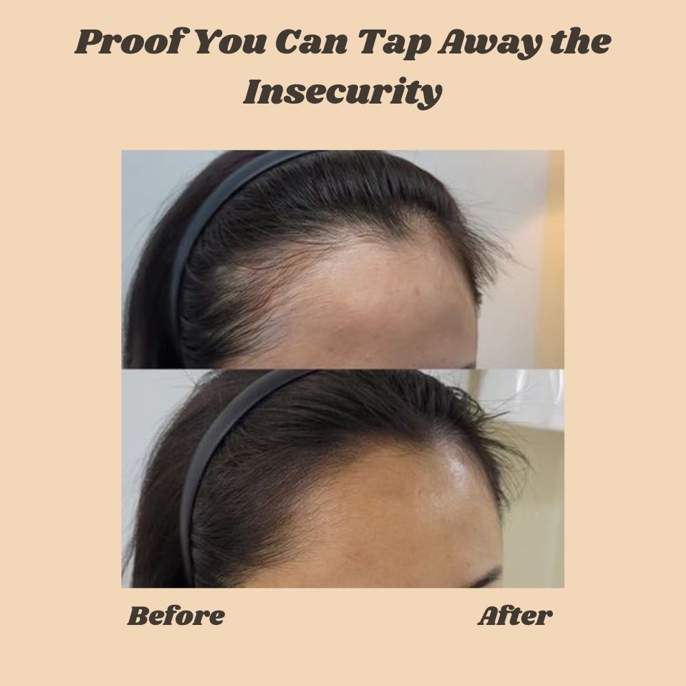 Hairline Touch-Up Stick for Thinning Hair & Part Coverage