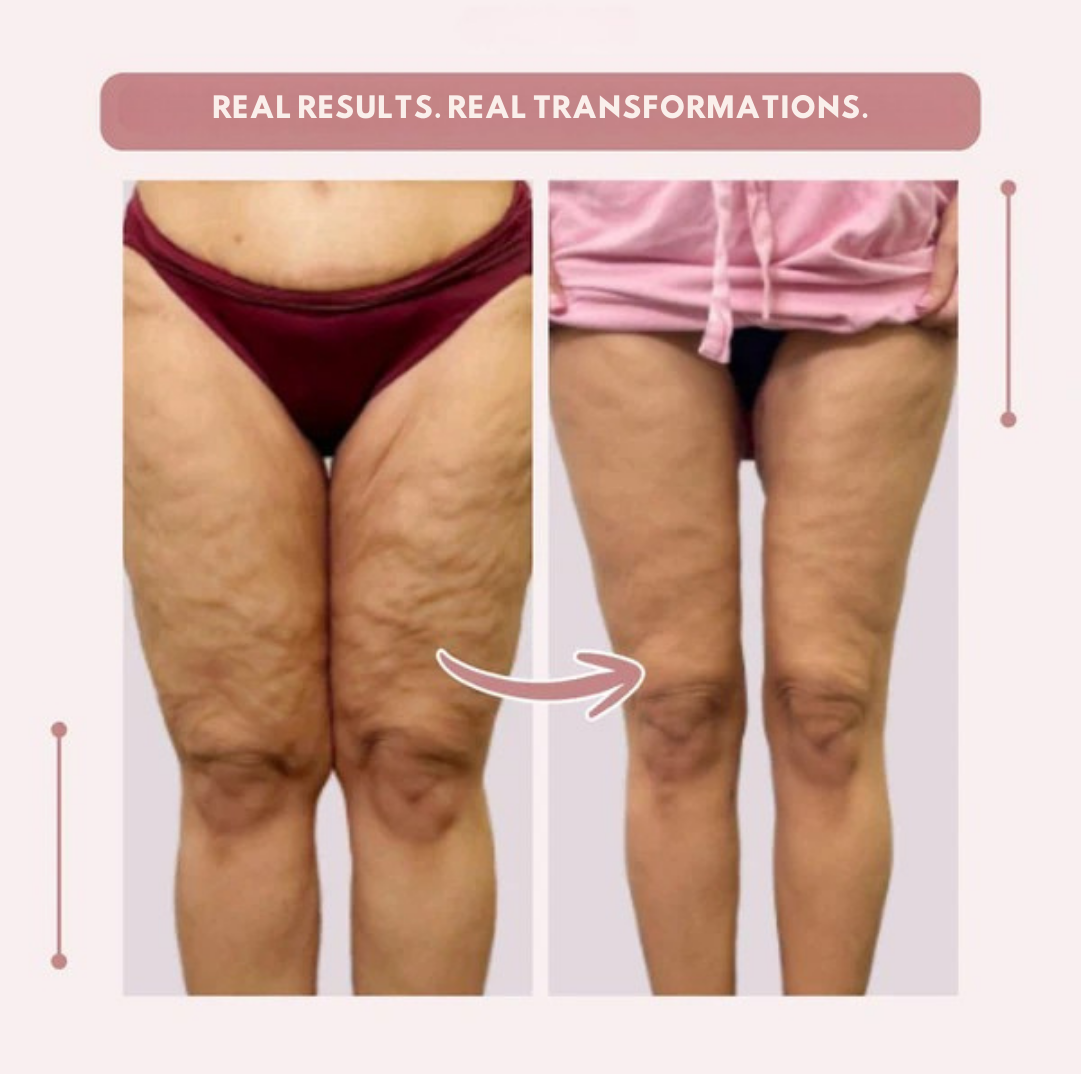 AquaLure — Korkeavyötäröiset kompressioleggingsit