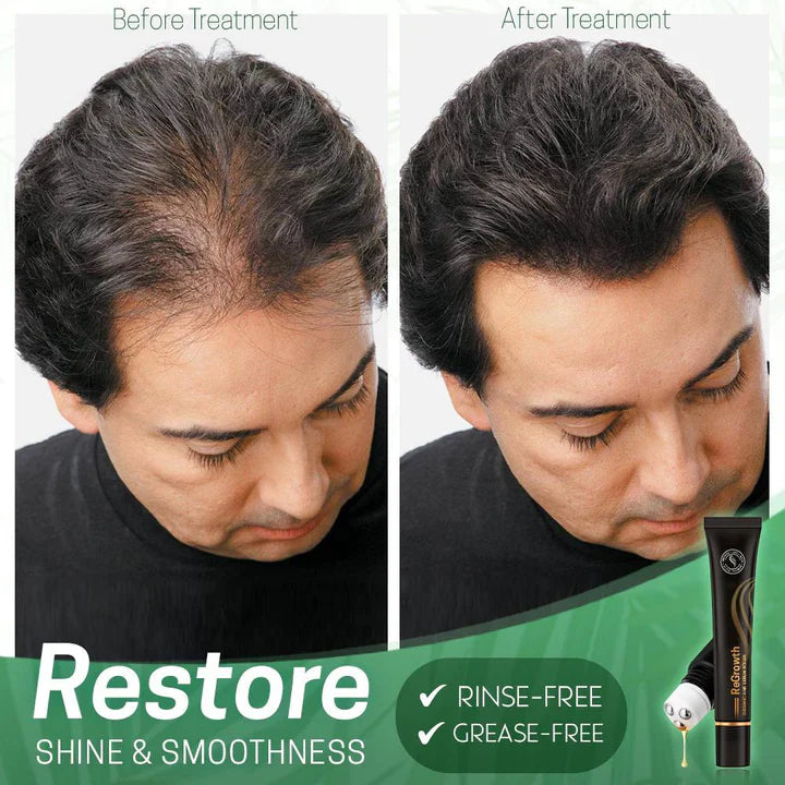 StrandSurge Serum — Hair Growth Serum with Roller Applicator
