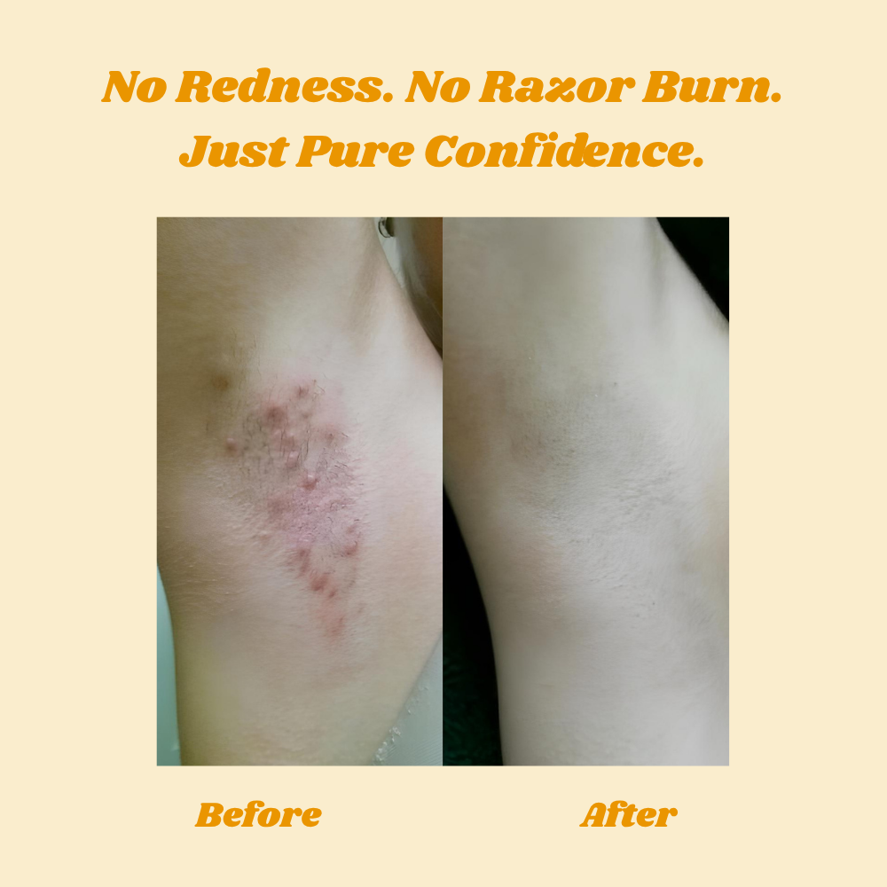 HoneyMousse - Hair Removal Foam | Gentle Skin Care Formula