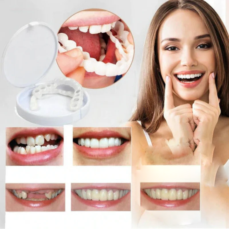 RadianceWrap — Temporary Cosmetic Smile Cover