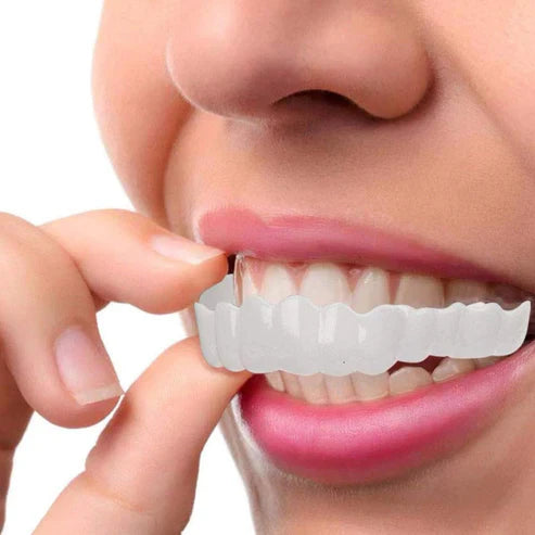 RadianceWrap — Temporary Cosmetic Smile Cover
