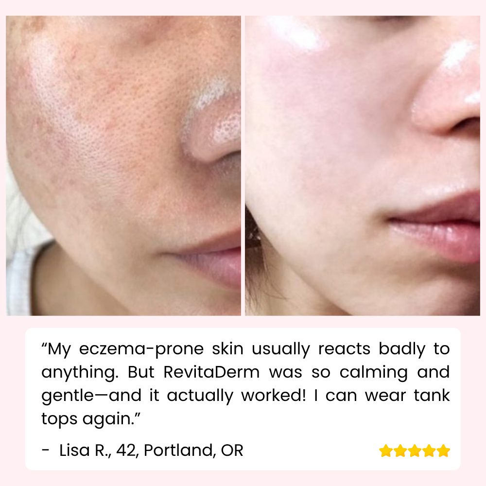 RevitaDerm — Gentle Exfoliating Gel for Daily Skin Care