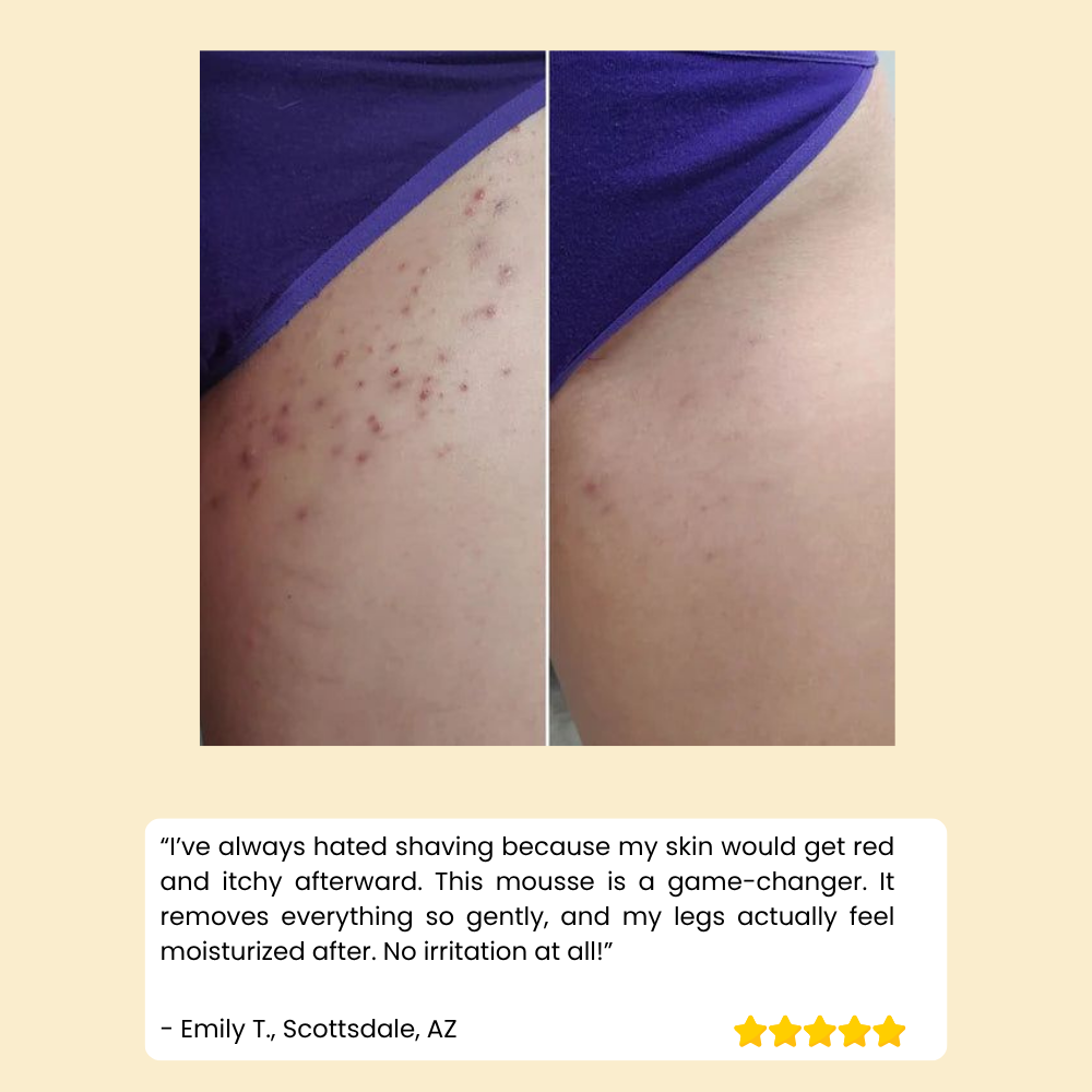 HoneyMousse - Hair Removal Foam | Gentle Skin Care Formula