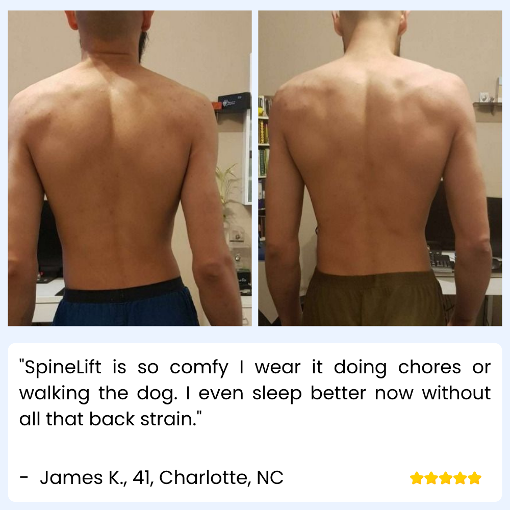 SpineLift — Adjustable Posture Support Brace