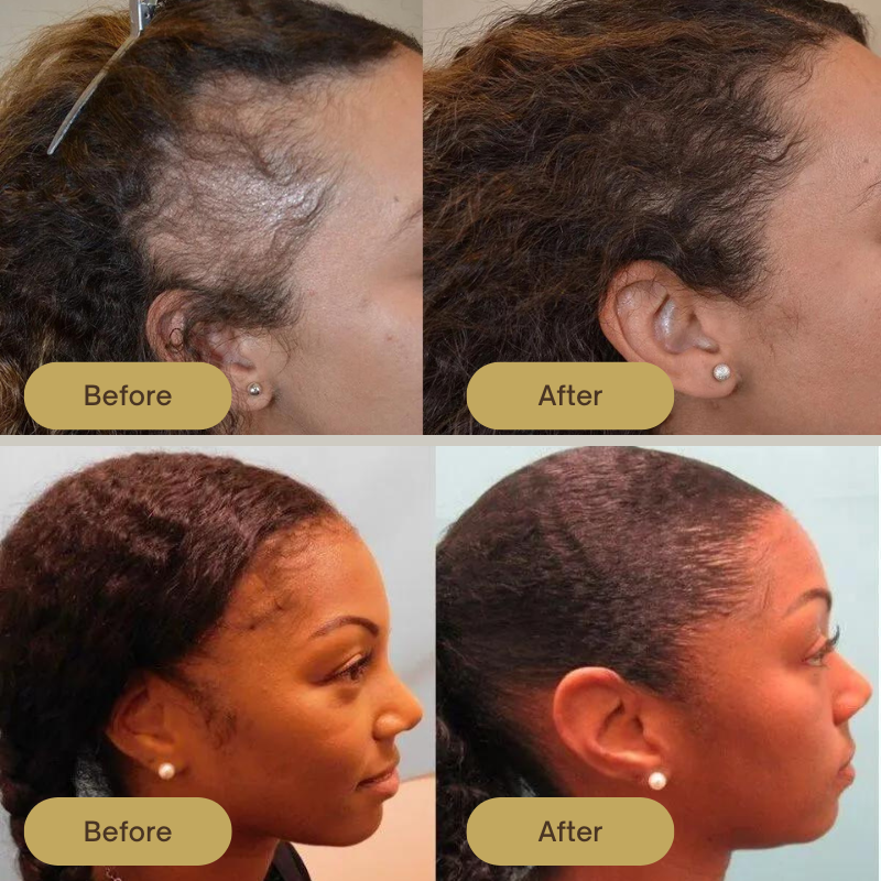 FolliPrime - Synergy Oil Set with Scalp Massager