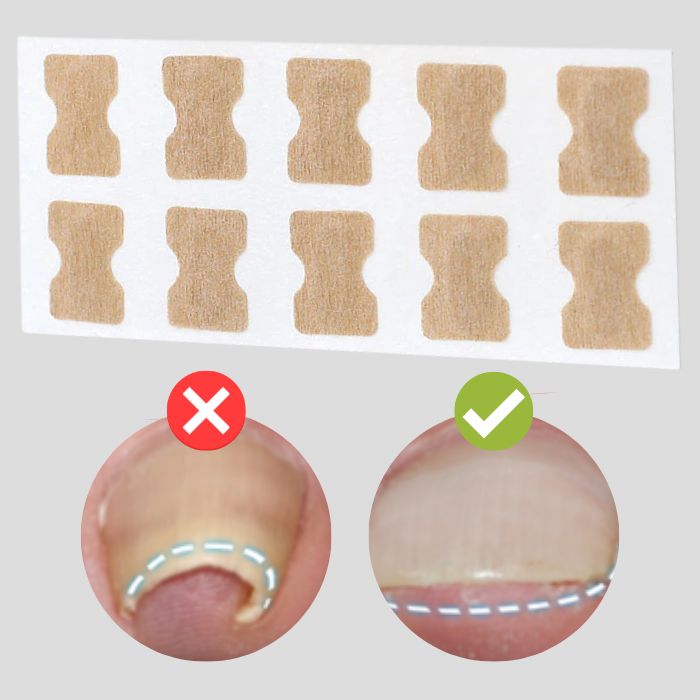 FinePatches - Nail Care Patches