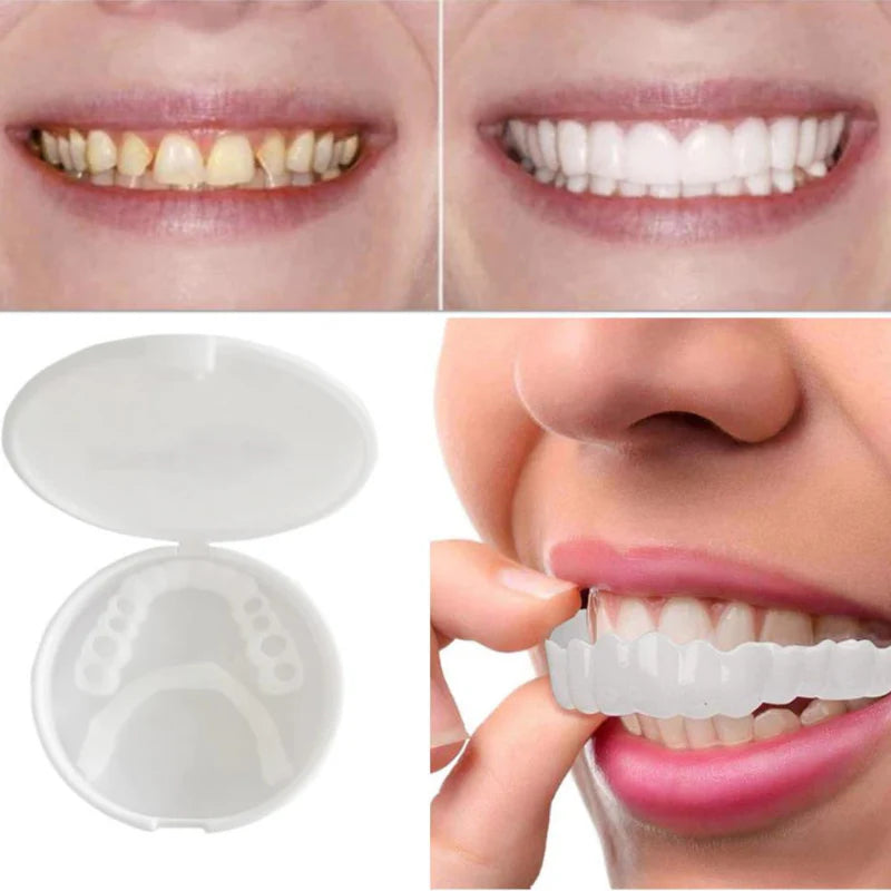 SmileSculpt — Removable Snap-On Veneers for a Brighter Looking Smile